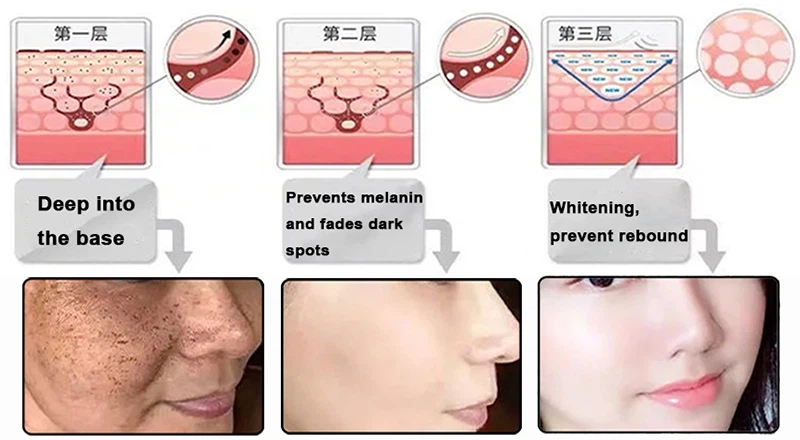 phenethyl resorcinol powder Whitening